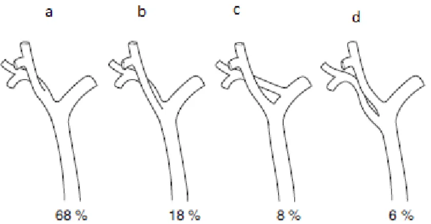 Figure 11 : Schéma illustrant les principales variantes   anatomiques des voies biliaires [11]