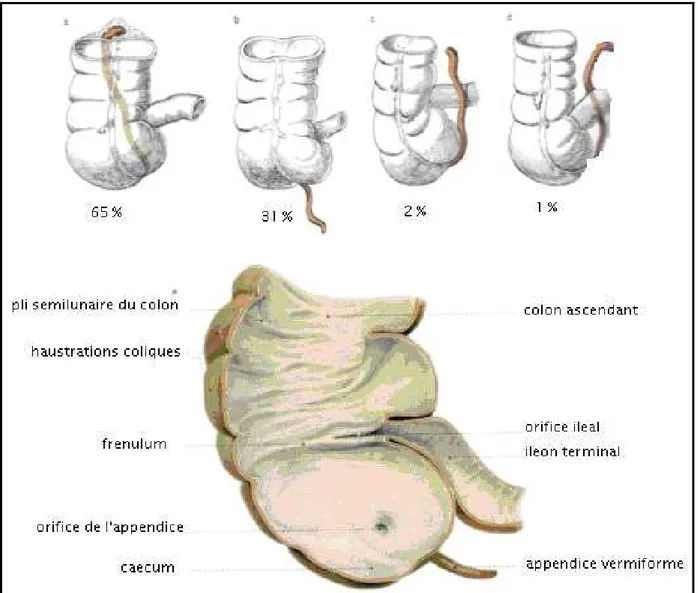 Fig. n 2 : les anomalies positionnelles de l’appendice.(9) 