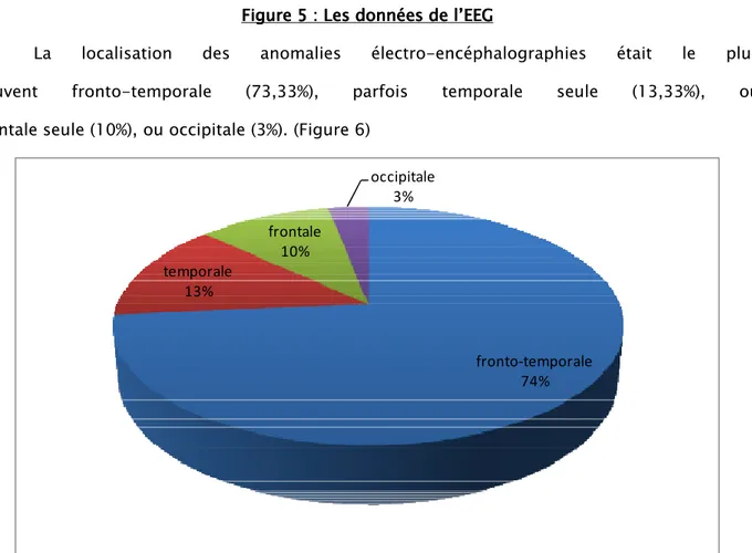 Figure 5    : Les : Les : Les : Les    données de l’EEG données de l’EEG données de l’EEG     données de l’EEG