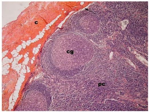 Figure 2 : ganglion lymphatique à moyen grossissement 
