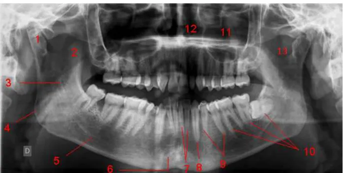 Figure 25    : panoramique dentaire. : panoramique dentaire. : panoramique dentaire. : panoramique dentaire