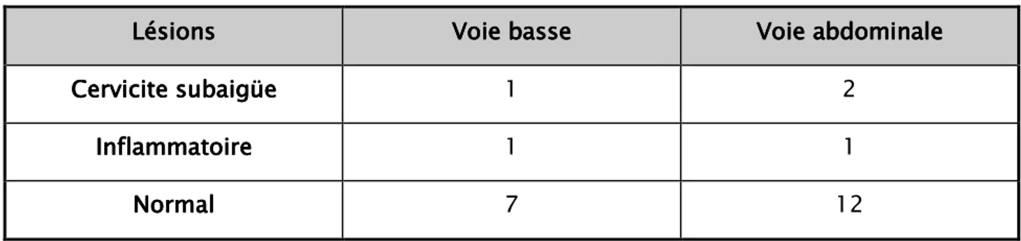 Tableau XTableau X