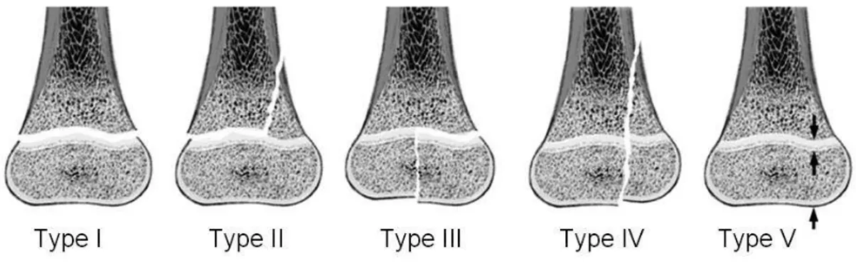 Figure 1 Figure 1 Figure 1