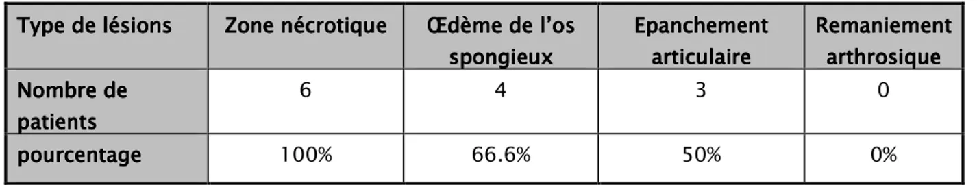 Tableau IV    :  :  :  : Répartition en fonction du stade radiologique (n=11)  Classification de Arlet et 