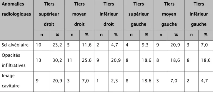 Tableau X Tableau XTableau X