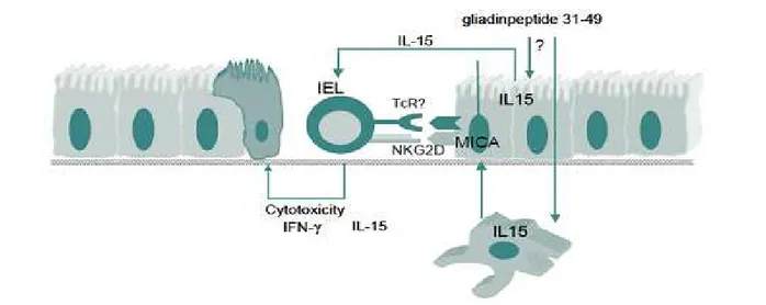 Figure II :  Mechanisms leading to the activation of IEL by IL-15 in celiac disease .   