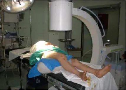 Figure 10 : installation du patient installation du patient installation du patient installation du patient    
