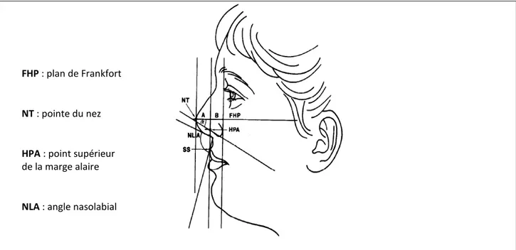 Figure 20 : Evaluation esthétique du nez dans le plan horizontal      