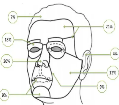 Figure 9 : Répartition  des tumeurs selon les unités esthétiques de 