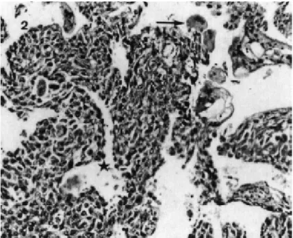 Figure    8 8 8 8: Cellule cytotrophophoblastique (►), et cellule 