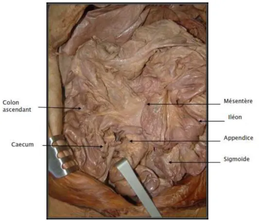 Figure 7    :  :  : les rapports de l’appendice dans l’abdomen (2)  : 