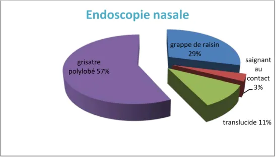 Figure 4 : Caractéristiques endoscopiques de la tumeur de la fosse nasale.  Tableau I : Les résultats de l’endoscopie nasale 