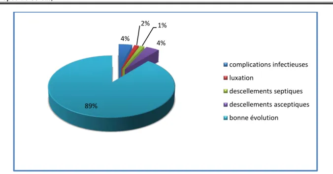 Figure 33 : Répartition des cas selon la présence ou non de complications 