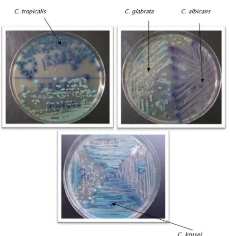 Fig. 3 : Identification des espèces de  Candida  sur le milieu chromogénique.   [Photos du service de Parasitologie-Mycologie médicale  de l’HMA de Marrakech] 