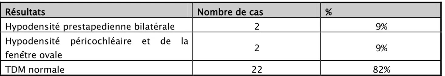 Tableau V : Résultats de la TDM 