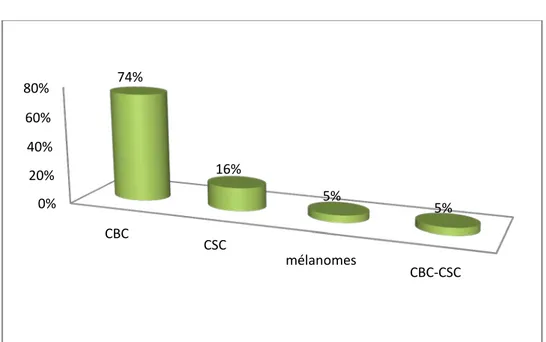 Figure 12 : Différents types de CBC  