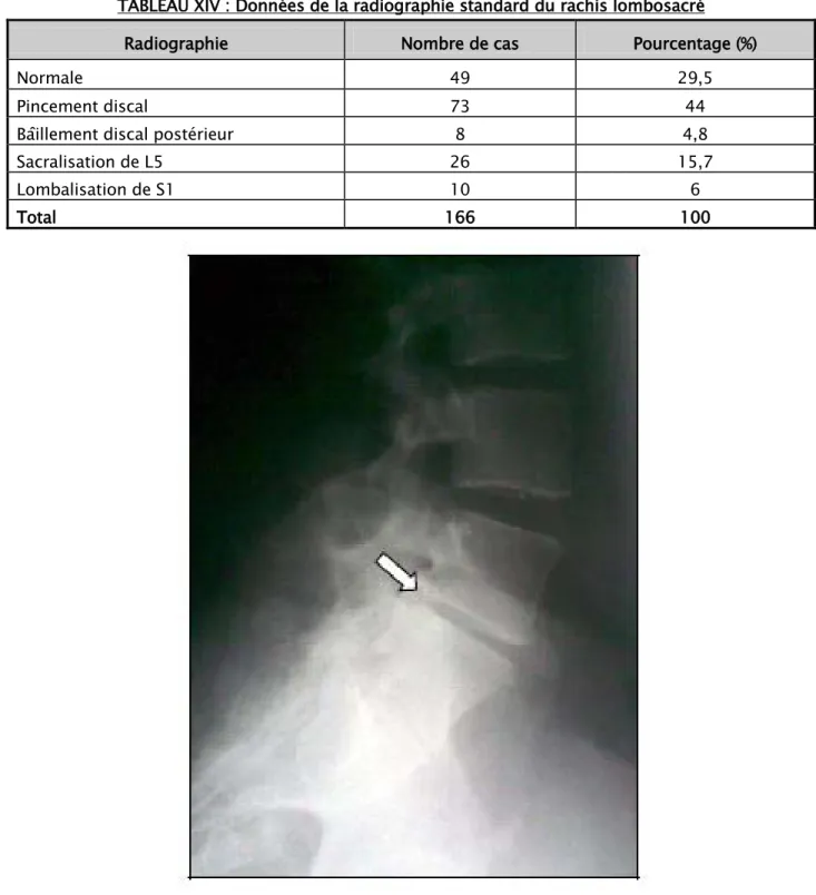 TABLEAU XIV : Données de la radiographie standard du rachis lombosacré 