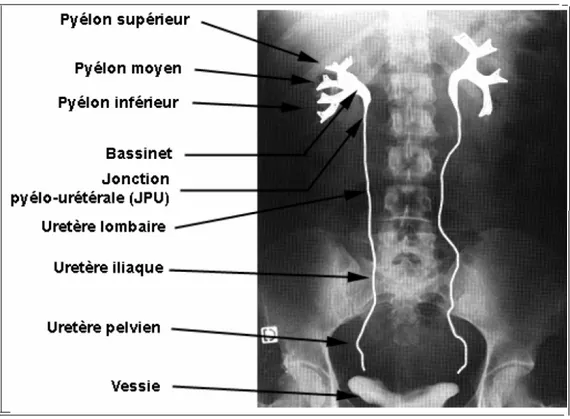 Figure 4 : UIV montrant les differents portions de l’appareil urinaire 