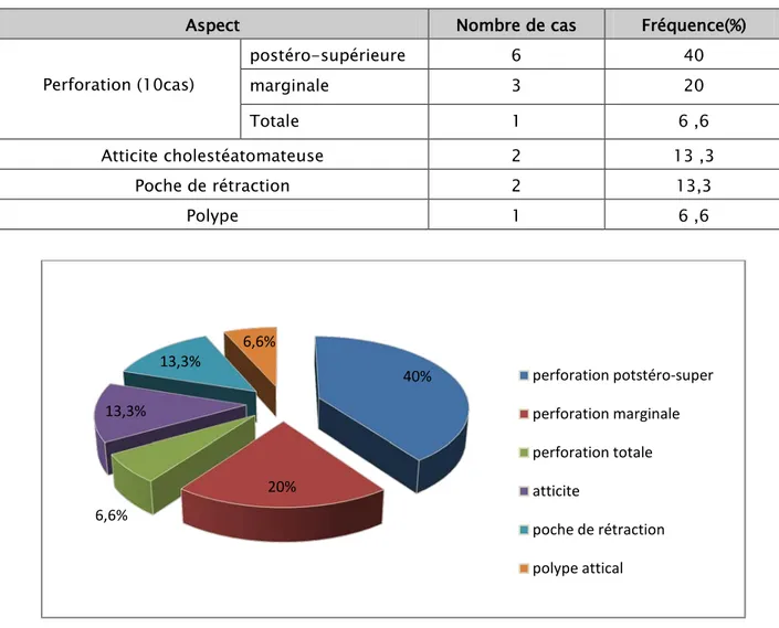 Tableau III : résumée de la fréquence des aspects otoscopique de l’oreille malade : 