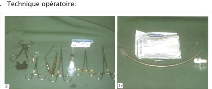 Figure 1 : Équipement requis pour une intubation sous-mentonnière :   a/ matériel chirurgical   b/sonde endotrachéale armée 