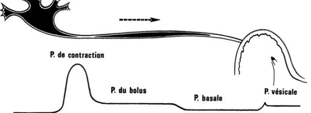 Figure 10: la pression dans l'uretère est différente selon le niveau,  