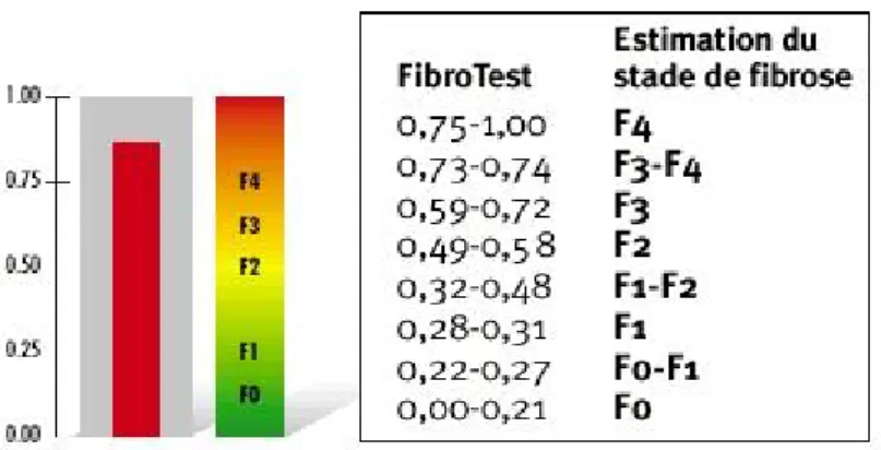 Figure 8 : exemple d’un fibrotest 