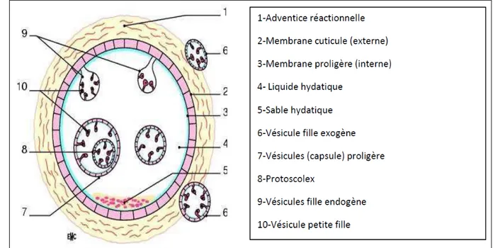 Figure 4 : Structure du kyste hydatique pulmonaire  [16] 