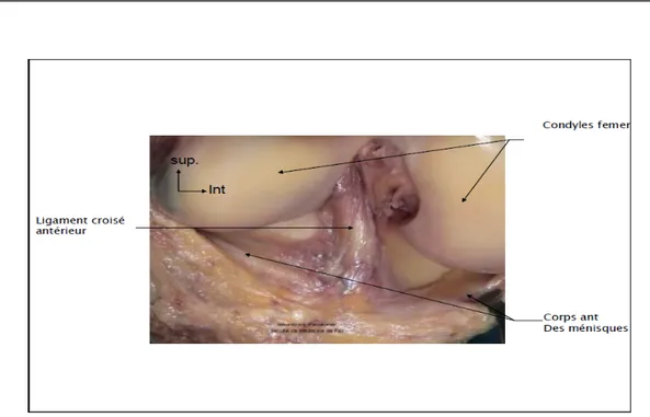 Figure 28 : Vue antérieure après ouverture de l’articulation du genou   montrant  le  ligament  croisé antérieur et corps antérieur  des ménisques 