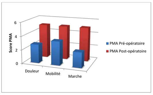 Figure 31 : Évolution des scores PMA pré et postopératoires. 0 2 4 6 Douleur Mobilité Marche Score PMA  PMA Pré-opératoire  PMA Post-opératoire 