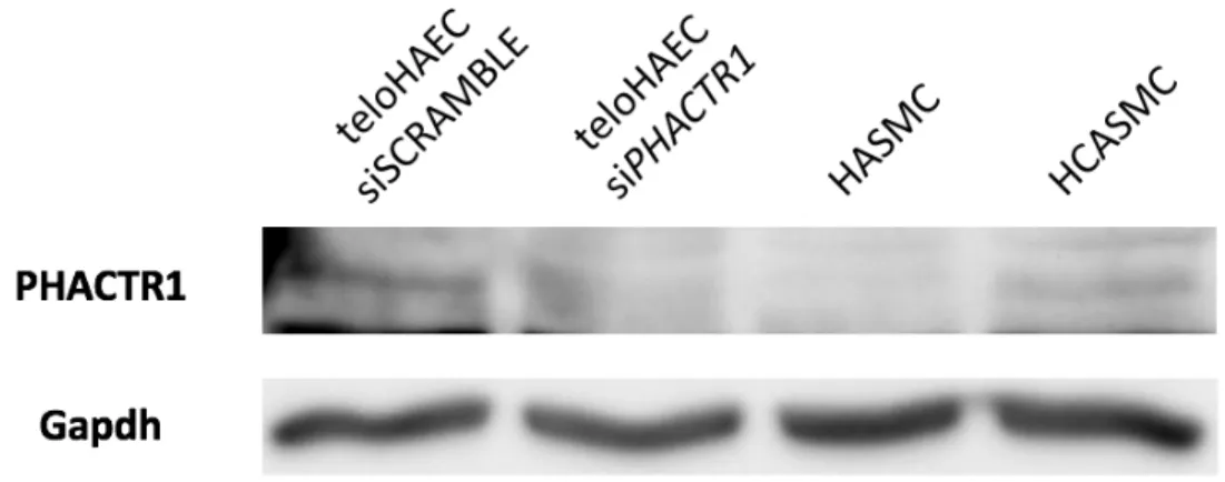 Figure 11 :  Presence  of  PHACTR1  protein  in  vascular  smooth  muscle  cells.  We  tested  for  the 