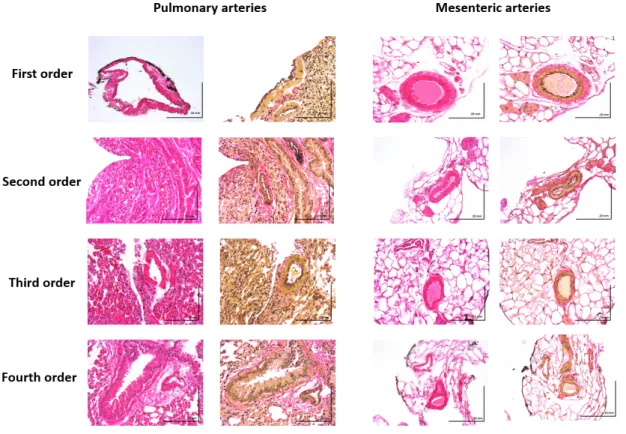 Figure  2  Structural  differences  between  pulmonary  arteries  and  mesenteric  arteries  of  mice  