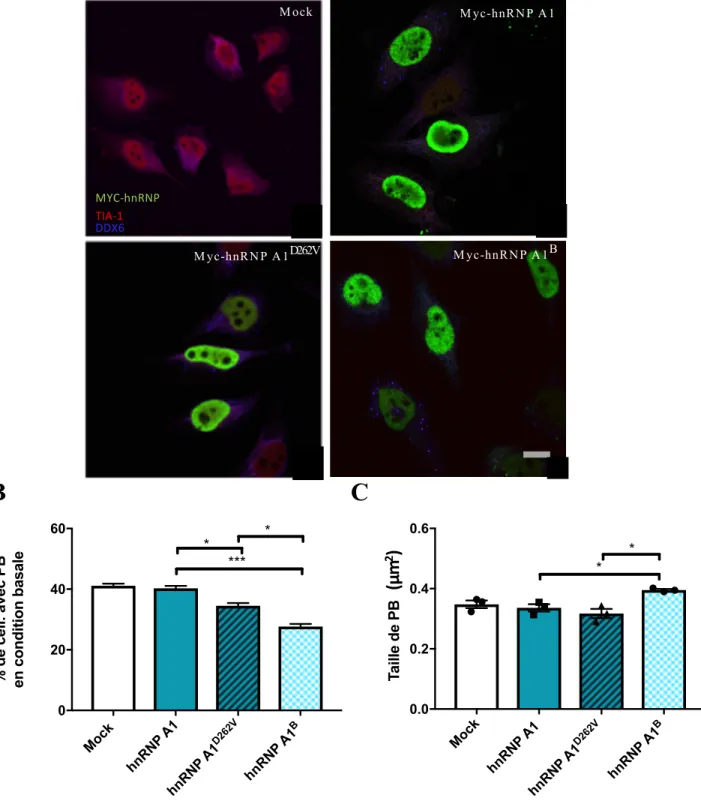 Figure 10. L’expression de hnRNP A1 B perturbe la dynamique des PB en condition basale