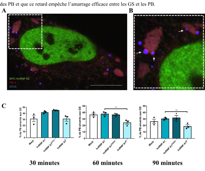Figure 12.  L’amarrage entre les GS et les PB est réduit dans les cellules exprimant  hnRNP A1 B  (A-C) Les cellules HeLa, stressées, ont été transfectées avec les l’ADNc et 