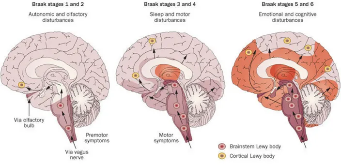 Figure 7: Braak Staging System of Parkinson’s Disease 