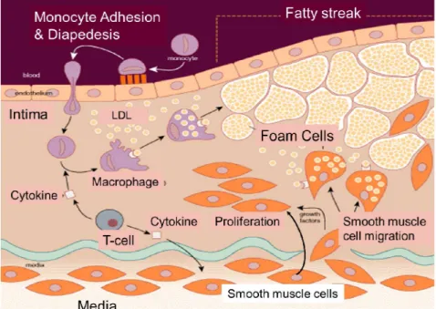 Figure 2.  La pathogenèse de l'athérosclérose 