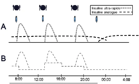 Figure 4. Exemples de schémas d’insulinothérapie par injections multiples et par perfusion 