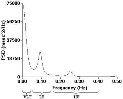 Figure 5. Représentation du spectre de fréquences dérivé d’un tachogramme. 