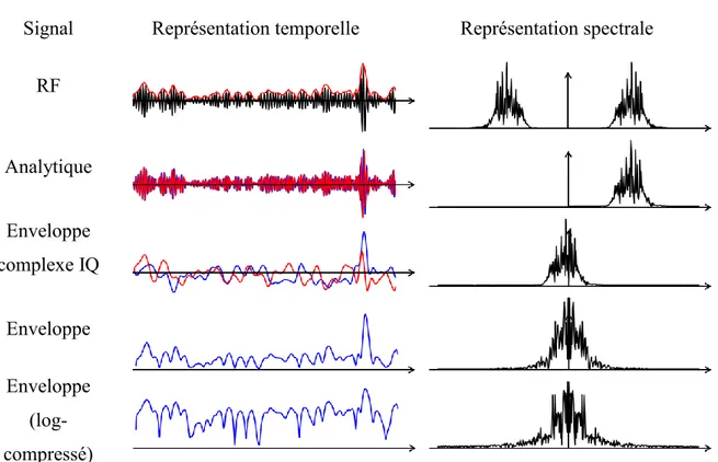 Table 2-1 – Représentation temporelle et spectrale d’un signal ultrasonore. 