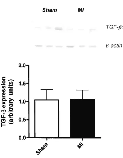 Figure 6 Sham MI TGF-f31 /3-a ctin ou) I X u-I c,c 2.O•1.51.0• o. G,