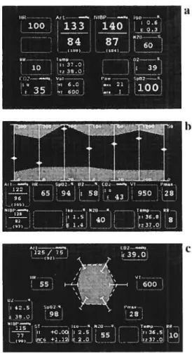 Figure 10: L’affichage en mode numérique (A), histogramme (B) et polygonal (C) utilisé par le stimulateur clinique