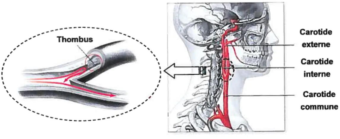 Figure 1.4: Anatomie de l’artère carotide et de son arborescence ainsi que de la bifurcation