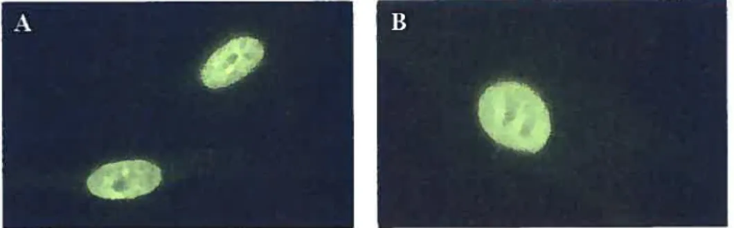 Figure 1. A et B. Exemptes de patron d’immunofluorescence indirecte d’anti-topo I sur des fibrobtastes humains.