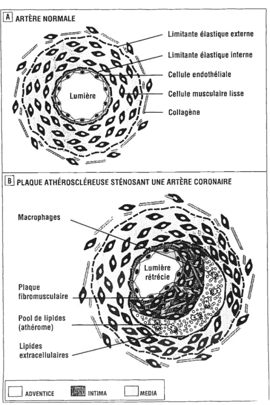 Figure 1. Représentation schématique des sections de la paroi vasculaire