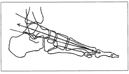 Figure 2.7. The Meary-Tomeno une (adapted from Shereff, 1991).