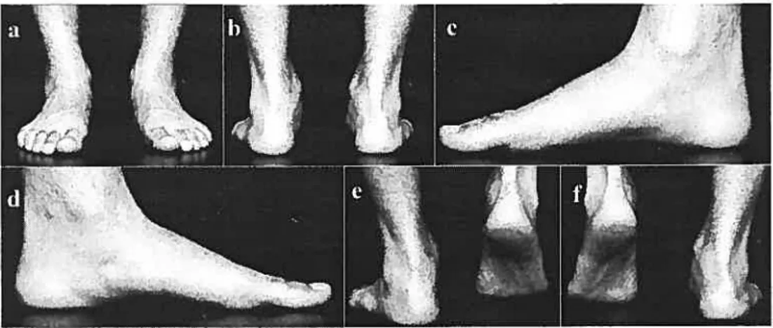 Figure 3.2. A single triai of images taken by Biovizion system, a) a ntero posterior view ofboth feet; b) postero-anterior view ofboth feet; c) mediai view of the right foot; d) medial of the lefi foot; e) posterior view of the right foot while plantar flexion and f) posterior view of the lefi foot while plantar flexion.