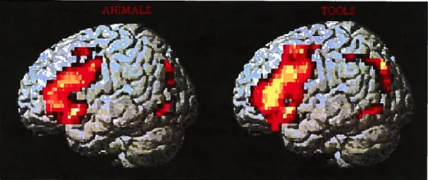 Figure 1. Cortical areas illustrating simple main effects in the two semantic fiuencv tasks.