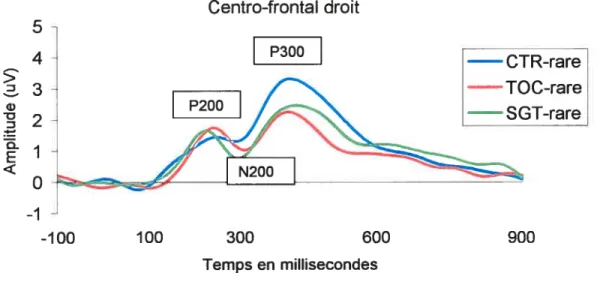 Figure 4. Comparaison des PÉC dans la condition rare sur les électrodes centro-frontales droites (Cz, F4, FC4, C4)