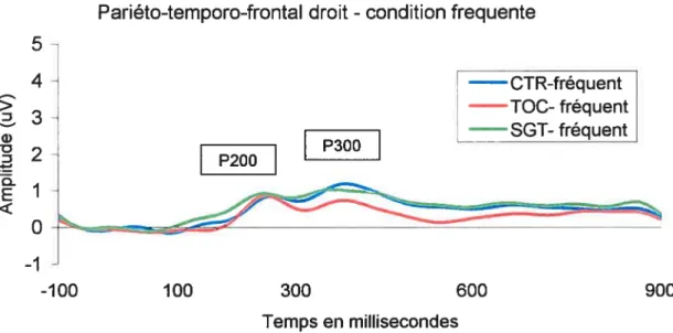 Figure 8. Comparaison des PÈC dans la condition fréquente sur les électrodes pariéto