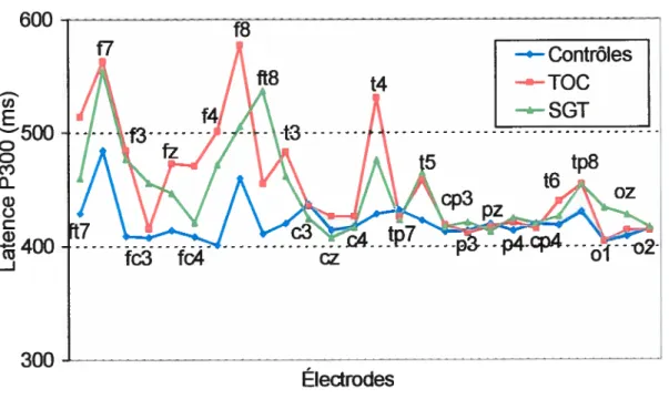 Figure 11. Illustration de la latence P300 reflétant l’apparition de la réponse aux stimuli rares