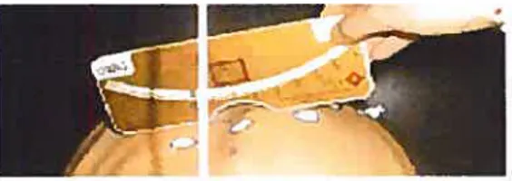 Figure 1-10 Figure illustrant le contrôle de la gibbosité à l’apex de la courbure à l’aide d’un scoliomètre ISource: Centre d’évaluation des pathologies du rachis, Hôpital Sainte-Justine].